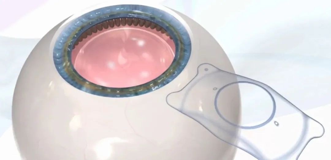 图片.png 图片.png