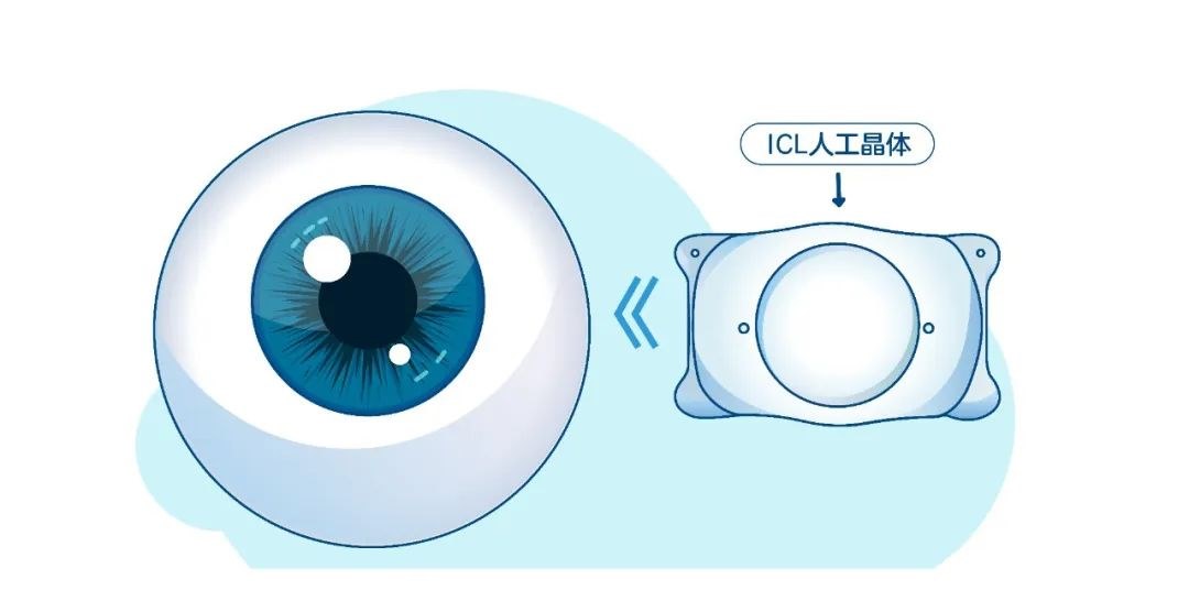 图片.png 图片.png