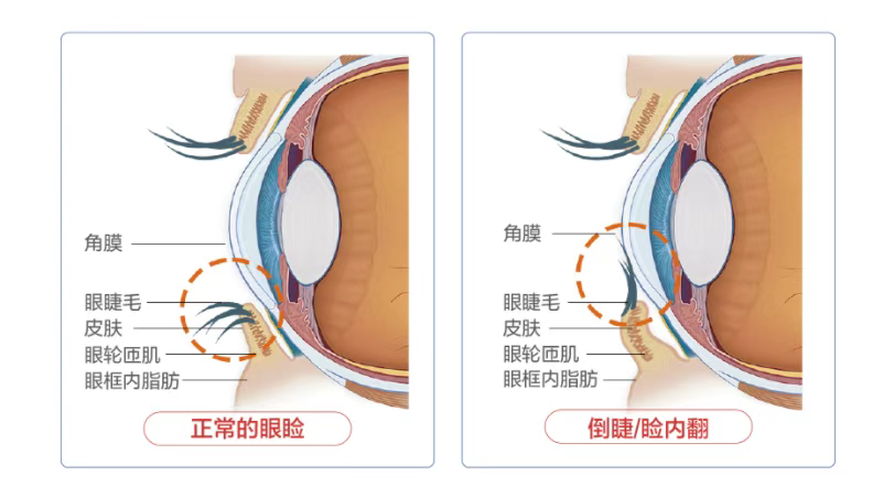 图片.png 图片.png