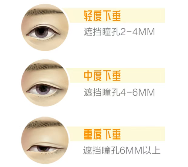 图片.png 图片.png